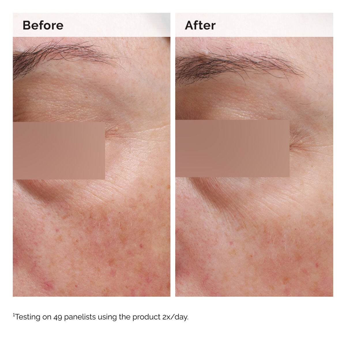 niacinamide-5-face-and-body-emulsion-o9 2024-08-23-ORD-Nia-5pct-Face-Body-B-A-Elasticity-Global-02-1x1.jpg