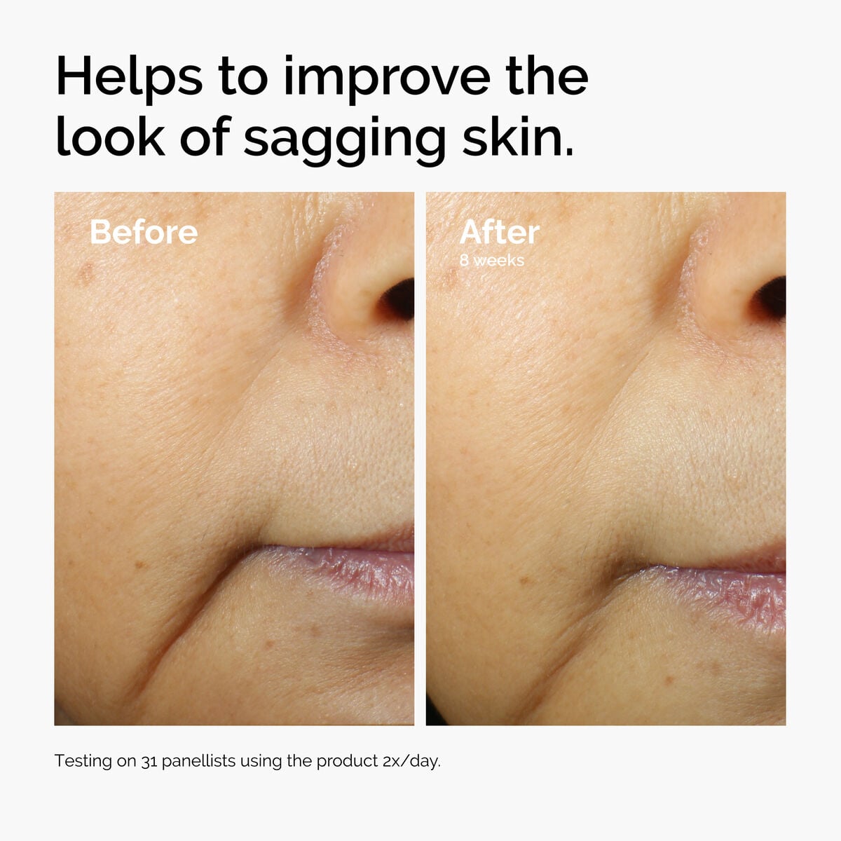 caffeine-3-escin-1-face-serum-w6 ord-caffeine-3pct-escin-1pct-face-serum-before-after-sagging.jpg