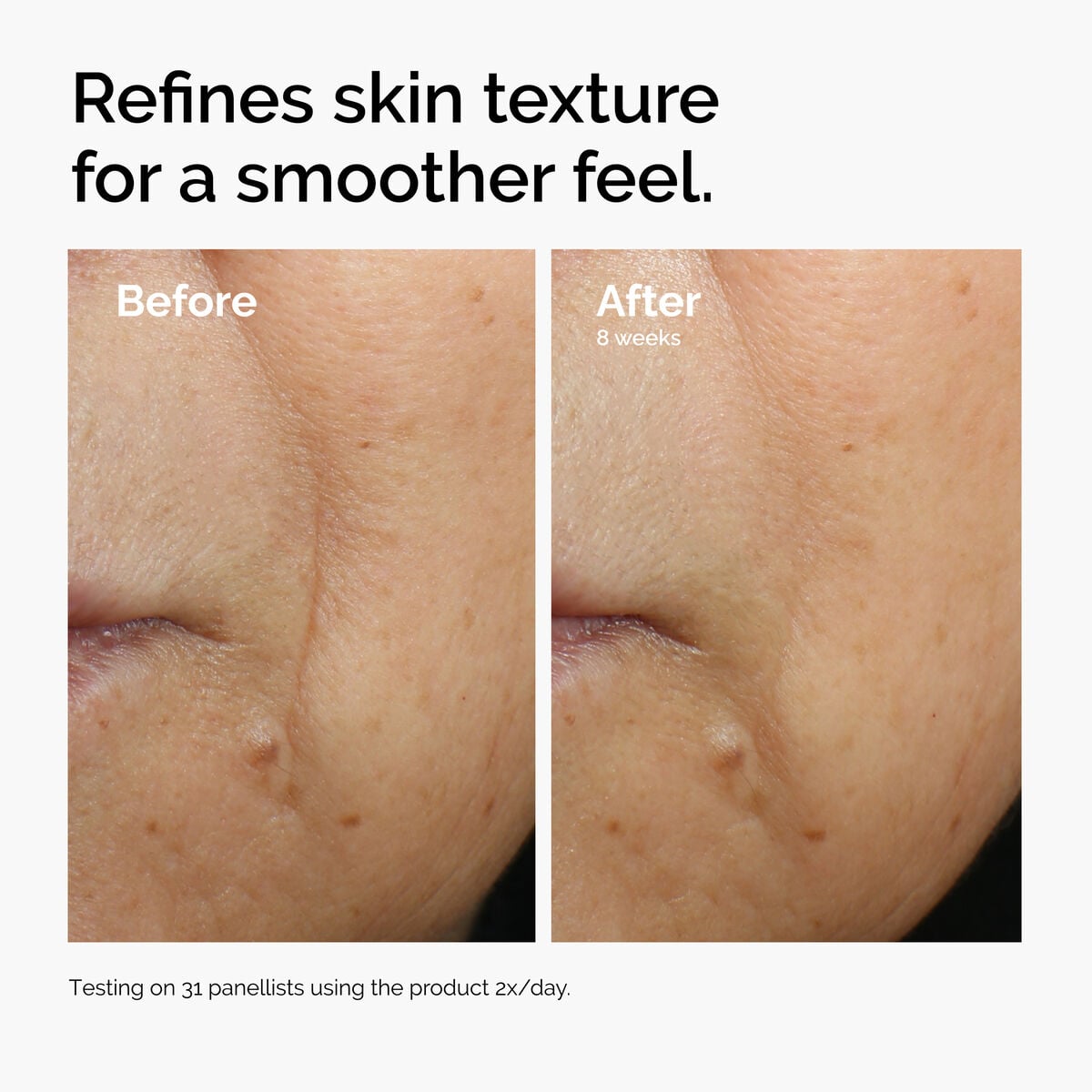 caffeine-3-escin-1-face-serum-w6 ord-caffeine-3pct-escin-1pct-face-serum-before-after-texture.jpg
