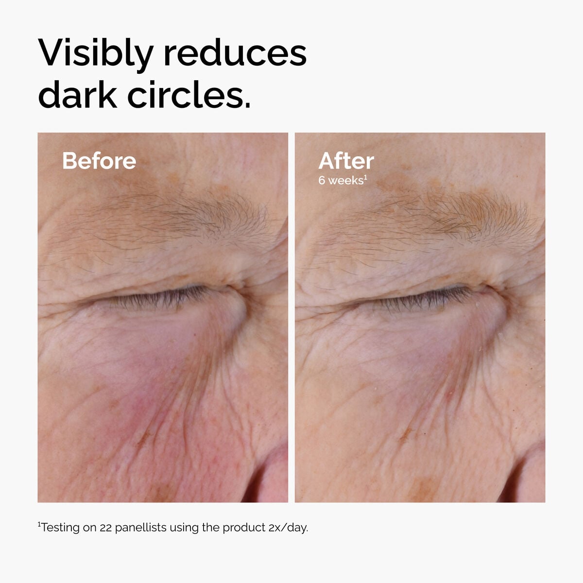 caffeine-solution-5-egcg-eye-serum-t8 ord-caffeine-solution-egcg-dark-circles-before-after.jpg