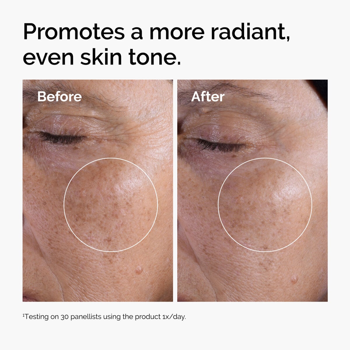 glycolic-acid-7-exfoliating-toner-p5 ord-glycolic-before-after-radiance.jpg