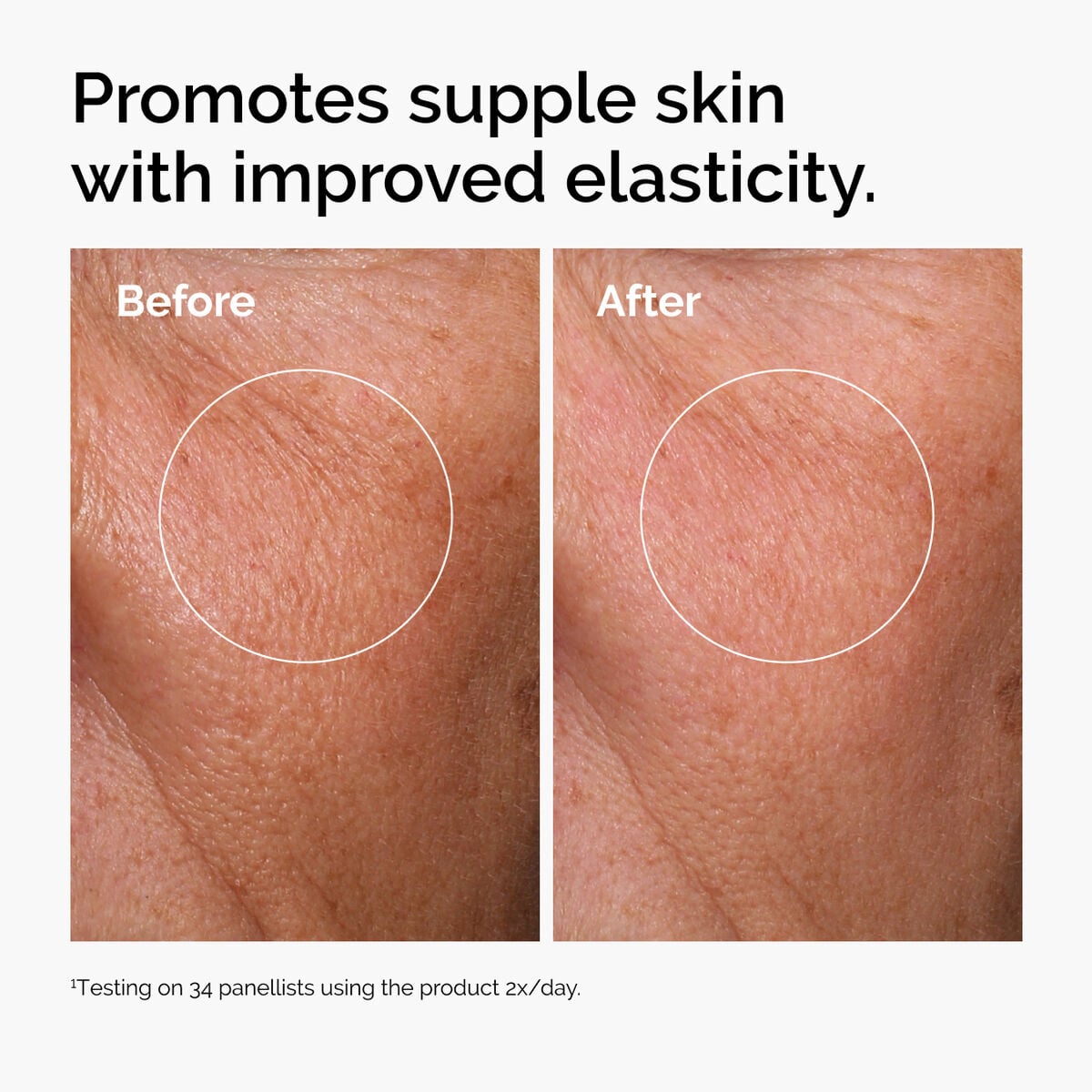hyaluronic-acid-2-b5-with-ceramides-r3 ord-hyaluronic-acid-2pct-b5-hydrating-serum-before-after-elasticity.jpg