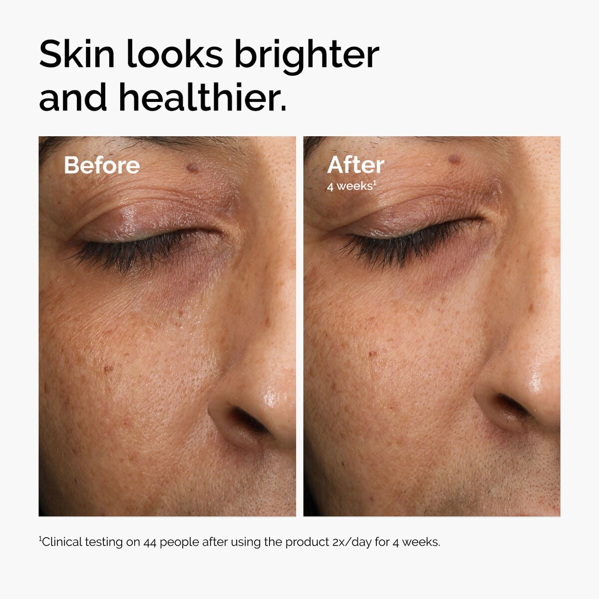 multi-antioxidant-radiance-serum-y2 ord-mars-before-after-healthy.jpg