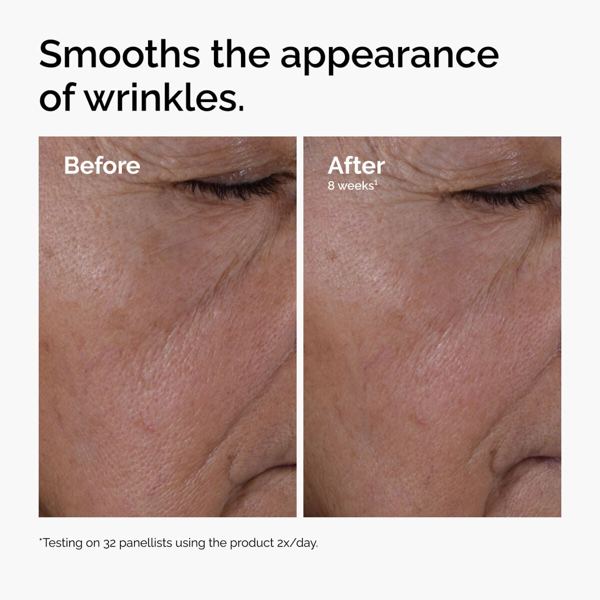 multi-peptide-ha-serum-h0 ord-multi-peptide-ha-serum-wrinkles-before-after.jpg