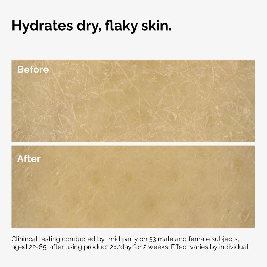 the-body-care-collection-q2 ord-natural-moisturizing-factors-inulin-body-before-after-graphic-02.jpg