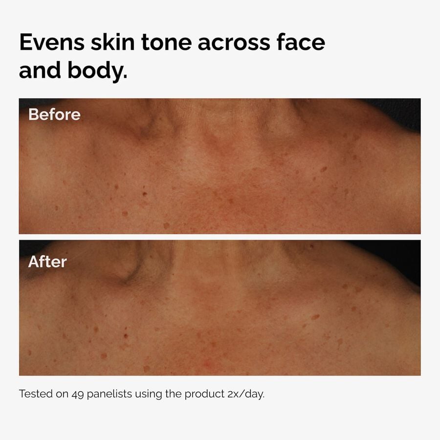 the-body-care-collection-q2 ord-niacinamide-face-body-serum-before-after-even-tone-graphic.jpg