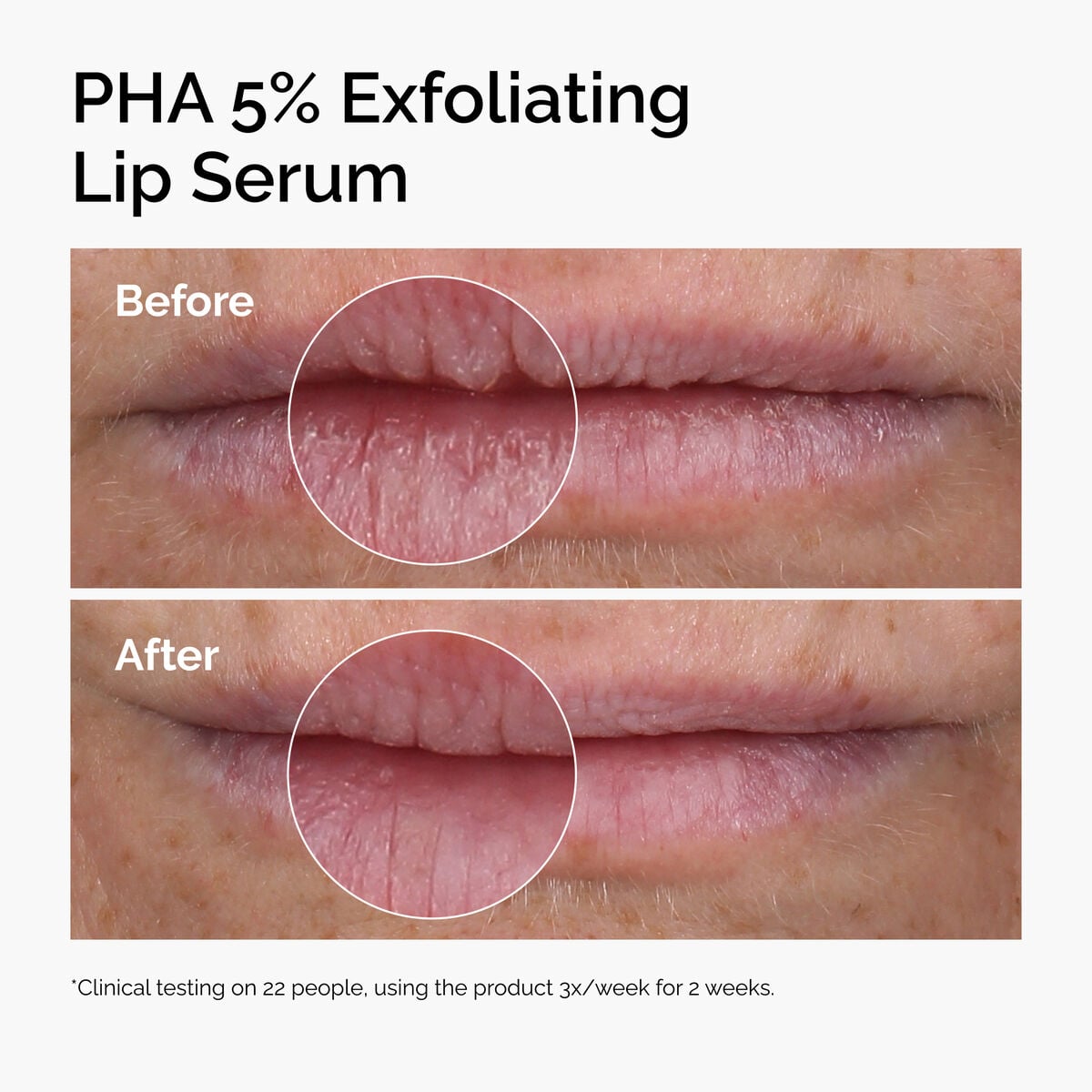 pha-5-exfoliating-lip-serum-u9 ord-pha-5pct-lip-exfoliating-serum-before-after.jpg